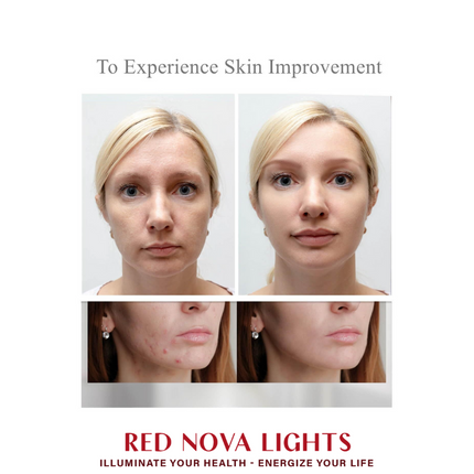 Red Light Therapy Face Mask – LED Skin Rejuvenation Mask with Red, Blue, Yellow + NIR (460–850nm)